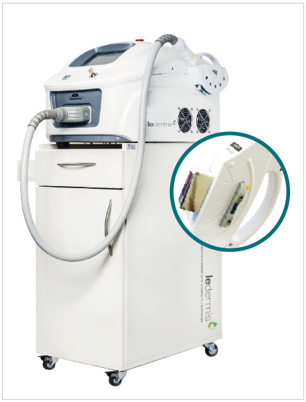 IPL Laser